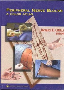 Hardcover Peripheral Nerve Blocks: A Color Atlas Book