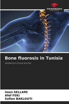 Paperback Bone fluorosis in Tunisia Book