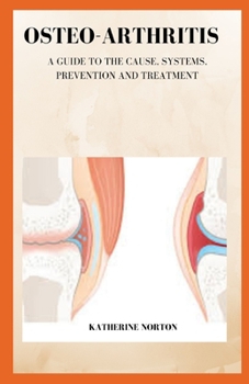 Paperback Osteo-Arthritis: A guide to the cause, systems, prevention and treatment Book