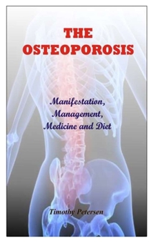Paperback The Osteoporosis: Manifestation, Management, Medicine and Diet Book