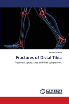 Paperback Fractures of Distal Tibia Book