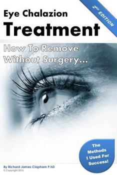 Paperback Eye Chalazion: How To Remove Without Surgery: My personal experience and the methods I used for success Book