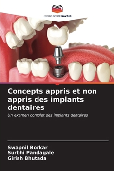 Paperback Concepts appris et non appris des implants dentaires [French] Book