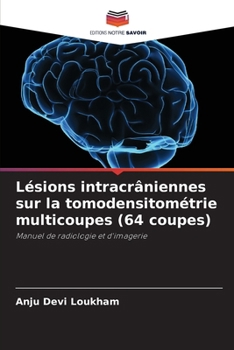 Lésions intracrâniennes sur la tomodensitométrie multicoupes (64 coupes): Manuel de radiologie et d'imagerie (French Edition)
