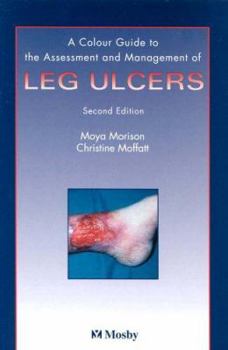Paperback Color Guide to the Nursing Management of Leg Ulcers Book