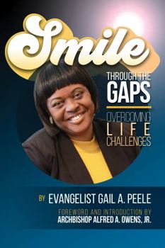 Paperback Smile Through the Gaps Book