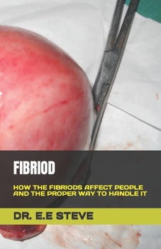 Paperback Fibriod: How the Fibriods Affect People and the Proper Way to Handle It Book