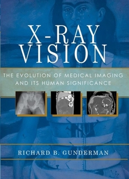 Paperback X-Ray Vision: The Evolution of Medical Imaging and Its Human Significance Book