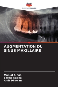 Paperback Augmentation Du Sinus Maxillaire [French] Book