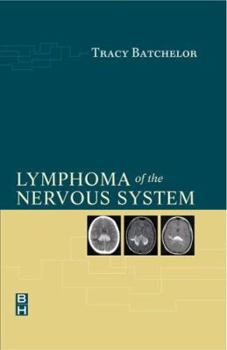 Hardcover Lymphoma of the Nervous System Book