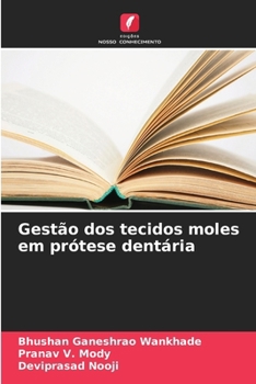 Gestão dos tecidos moles em prótese dentária (Portuguese Edition)