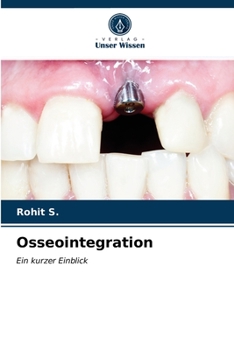 Paperback Osseointegration [German] Book