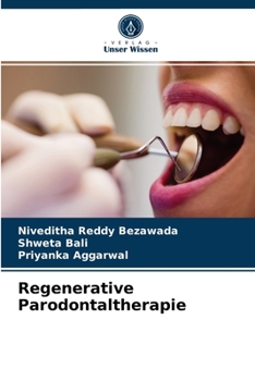 Paperback Regenerative Parodontaltherapie [German] Book