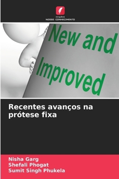 Paperback Recentes avanços na prótese fixa (Portuguese Edition) [Portuguese] Book
