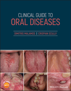 Paperback Clinical Guide to Oral Diseases Book