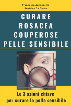 Paperback Curare Rosacea Couperose e Pelle Sensibile: Le 3 azioni chiave per curare la pelle sensibile [Italian] Book