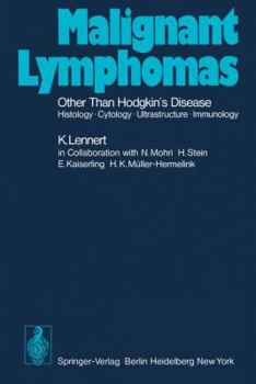 Paperback Malignant Lymphomas Other Than Hodgkin's Disease: Histology - Cytology - Ultrastructure - Immunology Book