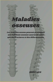 Maladies osseuses: Les troubles osseux peuvent provoquer une faiblesse osseuse anormale ainsi que des fractures et des déformations. (French Edition)