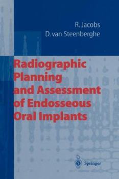 Paperback Radiographic Planning and Assessment of Endosseous Oral Implants Book