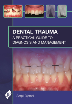 Hardcover Dental Trauma: A Practical Guide to Diagnosis and Management Book