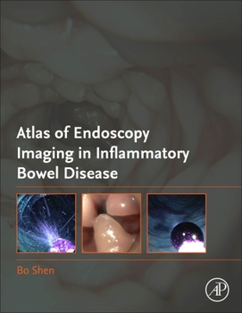 Hardcover Atlas of Endoscopy Imaging in Inflammatory Bowel Disease Book