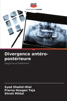 Paperback Divergence antéro-postérieure [French] Book