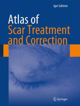 Hardcover Atlas of Scar Treatment and Correction Book