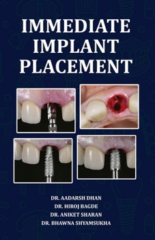 Paperback Immediate Implant Placement Book