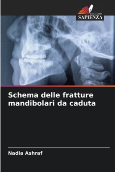 Paperback Schema delle fratture mandibolari da caduta [Italian] Book