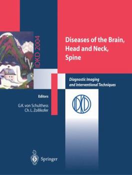 Paperback Diseases of the Brain, Head and Neck, Spine: Diagnostic Imaging and Interventional Techniques Book