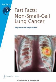 Paperback Fast Facts: Non-Small-Cell Lung Cancer: Nsclc Book