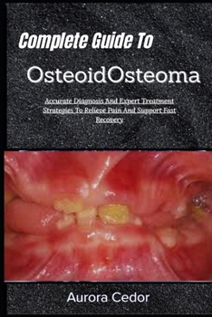 Complete Guide To OsteoidOsteoma: Accurate Diagnosis And Expert Treatment Strategies To Relieve Pain And Support Fast Recovery
