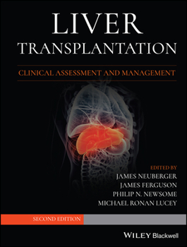 Hardcover Liver Transplantation Book