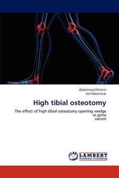 Paperback High tibial osteotomy Book