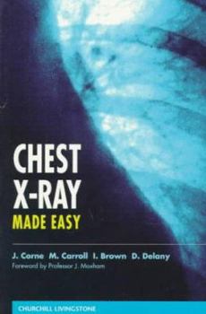 Paperback Chest X-Ray Made Easy Book