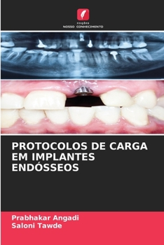Paperback Protocolos de Carga Em Implantes Endósseos [Portuguese] Book