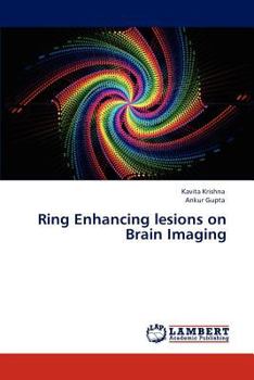 Paperback Ring Enhancing Lesions on Brain Imaging Book