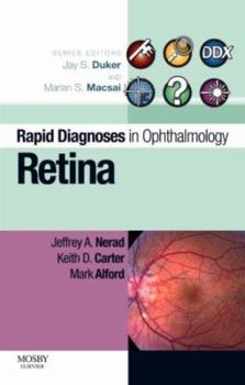 Paperback Rapid Diagnosis in Ophthalmology Series: Retina Book