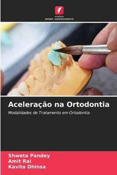 Paperback Aceleração na Ortodontia [Portuguese] Book