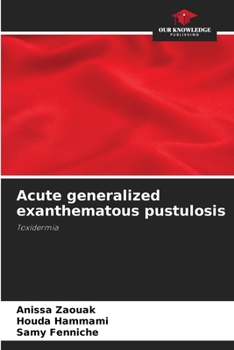 Paperback Acute generalized exanthematous pustulosis Book