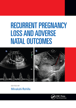 Paperback Recurrent Pregnancy Loss and Adverse Natal Outcomes Book