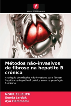 Paperback Métodos não-invasivos de fibrose na hepatite B crónica [Portuguese] Book
