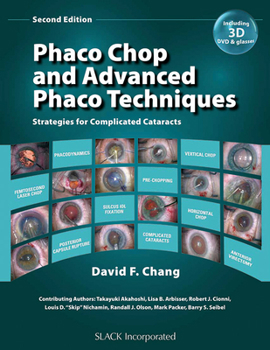 Hardcover Phaco Chop and Advanced Phaco Techniques: Strategies for Complicated Cataracts [With DVD] Book