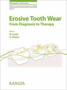 Hardcover Erosive Tooth Wear: From Diagnosis to Therapy Book