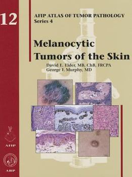 Hardcover Melanocytic Tumors of the Skin Book