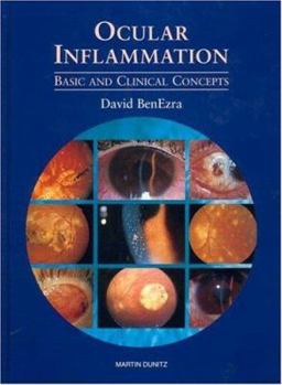 Hardcover Ocular Inflammation: Basic and Clinical Concepts Book