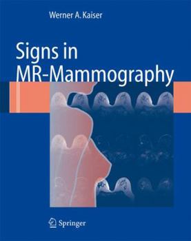 Paperback Signs in Mr-Mammography Book