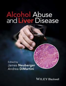 Hardcover Alcohol Abuse and Liver Disease Book