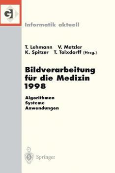 Paperback Bildverarbeitung Für Die Medizin 1998: Algorithmen -- Systeme -- Anwendungen Proceedings Des Workshops Am 26. Und 27. März 1998 in Aachen [German] Book