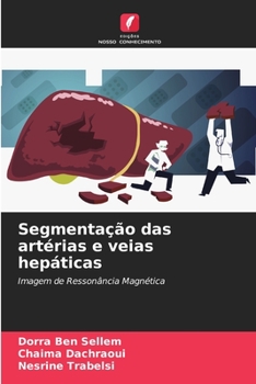 Paperback Segmentação das artérias e veias hepáticas [Portuguese] Book